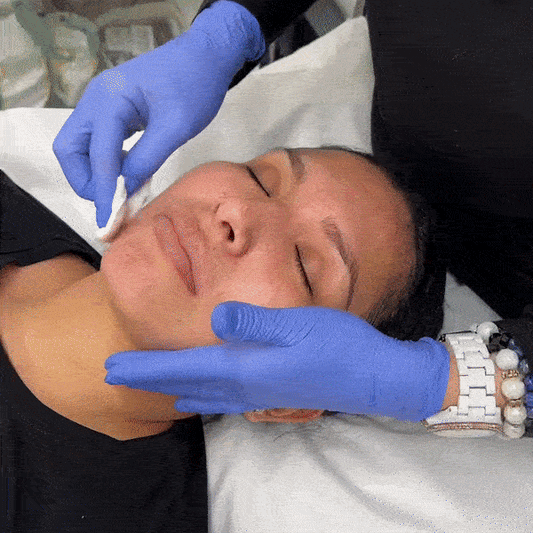 Il Miglior Trattamento Hydrafacial di Milano: Yanabeauté