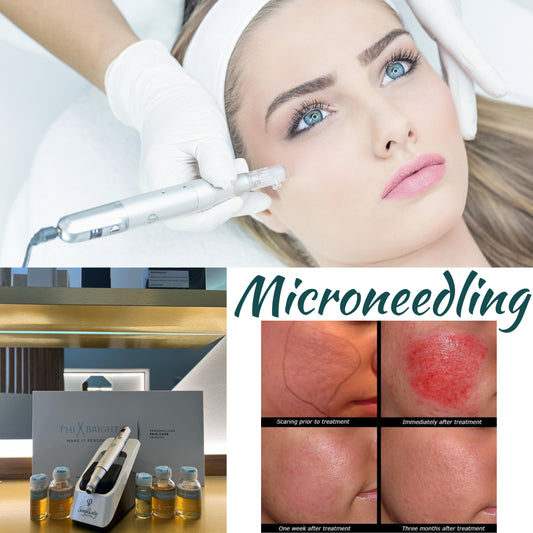 Beauty Awards 2023 per il Trattamento Microneedling di Yanabeuaté