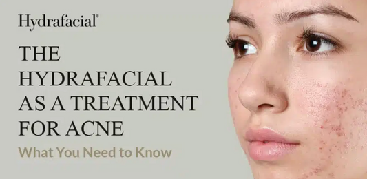 Scopri il Trattamento Anti-Acne Rivoluzionario: l'Hydrafacial di Yanabeauté
