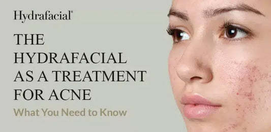 Stai ancora combattendo con acne, punti neri e pori ostruiti?