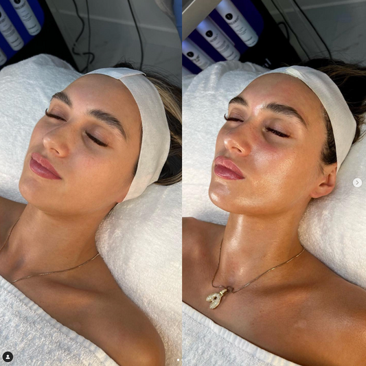 Il segreto per una pelle radiosa questa primavera: Facial Exclusive by Yana