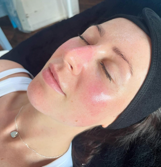Preparati all’Estate con una Pulizia del Viso Profonda Hydrafacial da Yanabeauté