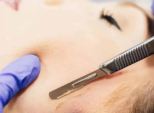 Il Dermaplaning: La Tua Strada Verso una Pelle Luminosa e Morbida