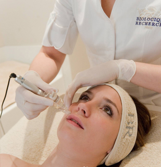 Trattamento Microneedling  a Milano by Yanabeauté