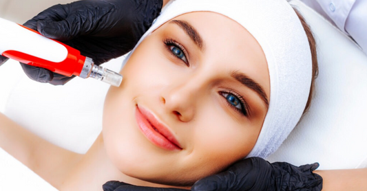 Microneedling Exclusive by Yanabeauté: il segreto per eliminare le macchie solari