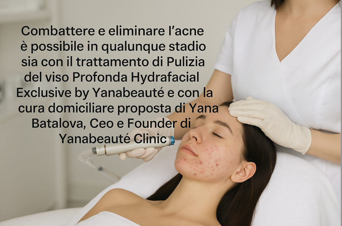 Combattere e eliminare l’acne è davvero possibile!!!